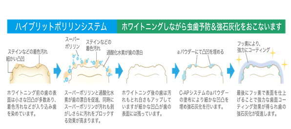 ホワイトニング